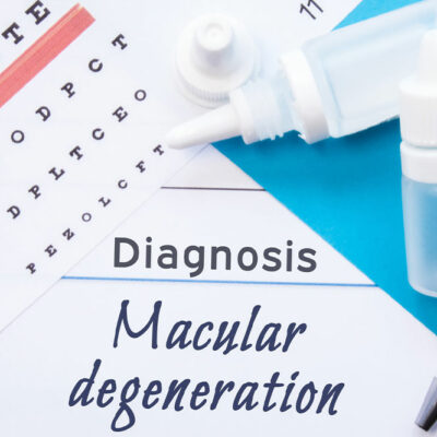 Key things to know about macular degeneration