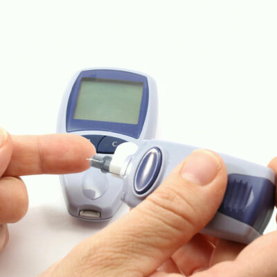 Hyperglycemia &#8211; Causes, symptoms, and management