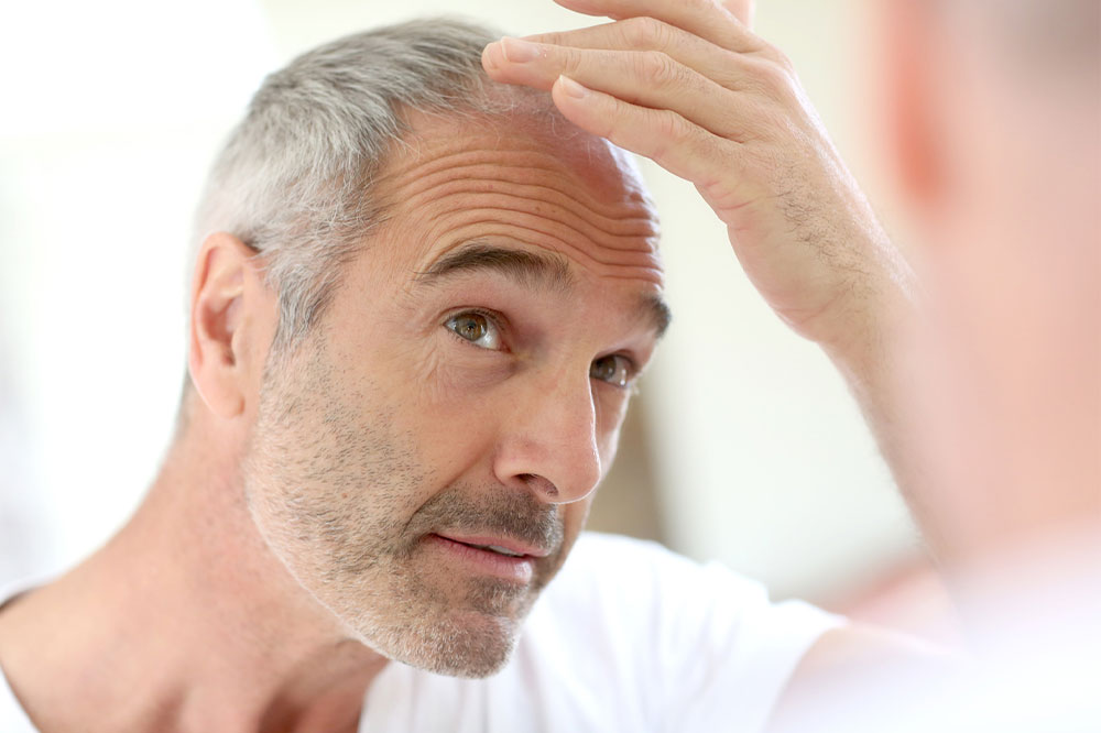 8 Medical Conditions That May Cause Severe Hair Loss