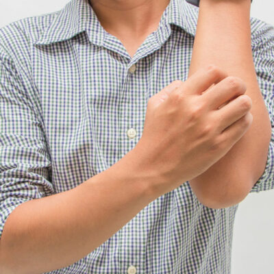 Eczema &#8211; Signs, Symptoms, and Home Remedies