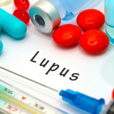 Lupus &#8211; Types and Warning Signs