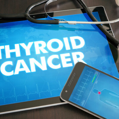 Various Aspects of Thyroid Cancer