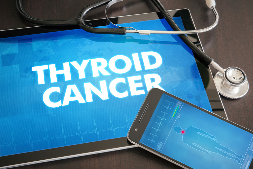 Various Aspects of Thyroid Cancer