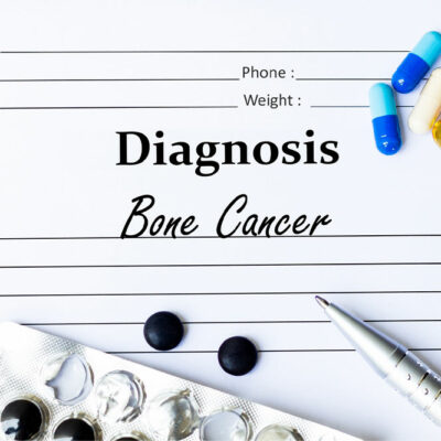 Bone cancer &#8211; Types, warning signs, lifestyle tips, and more