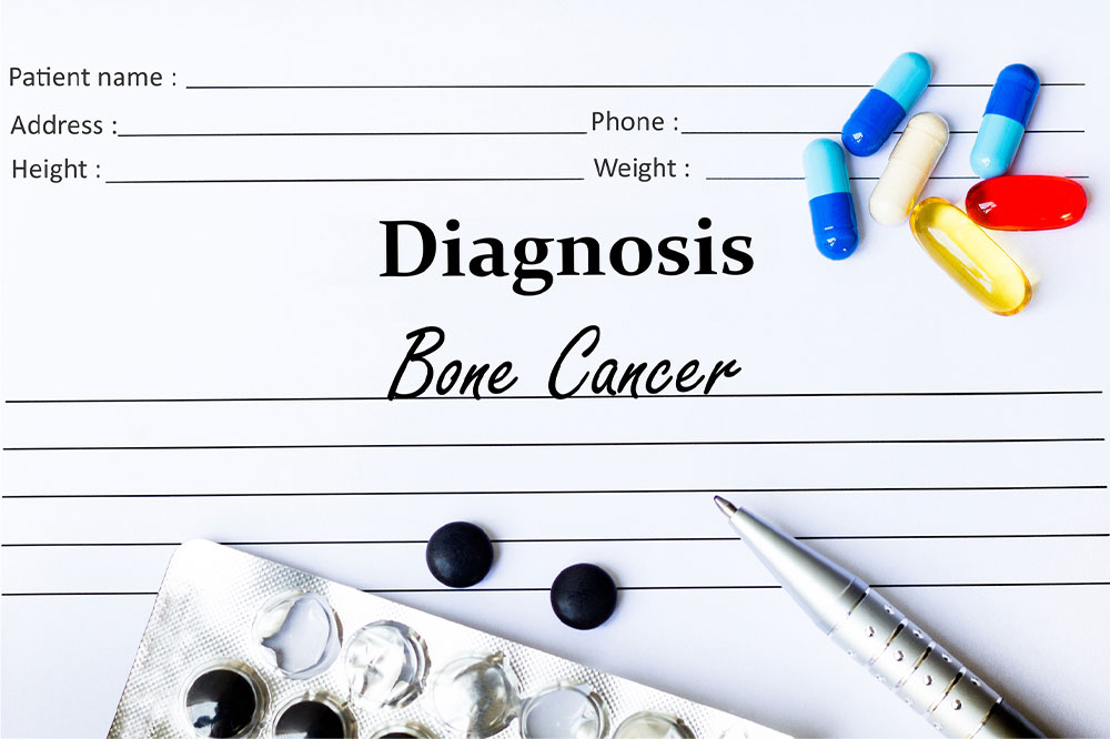 Bone cancer &#8211; Types, warning signs, lifestyle tips, and more