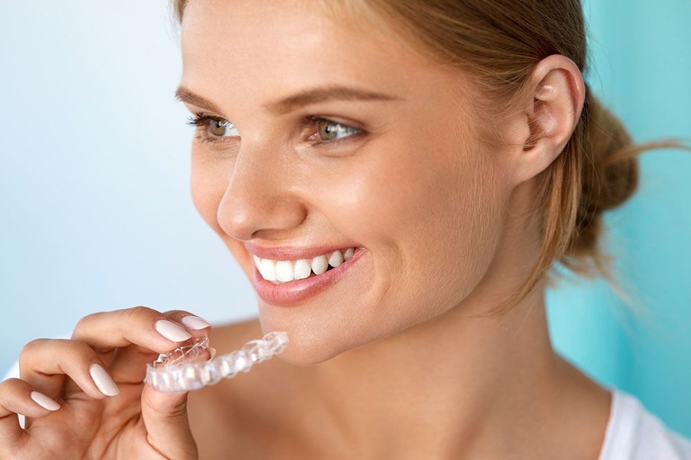 Invisible dental aligners &#8211; Benefits and tips to follow